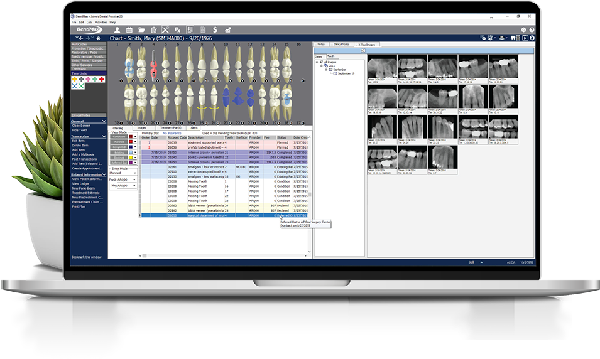 dental practice management software