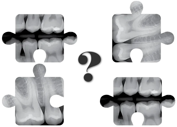 Dental Imaging integration with Patterson